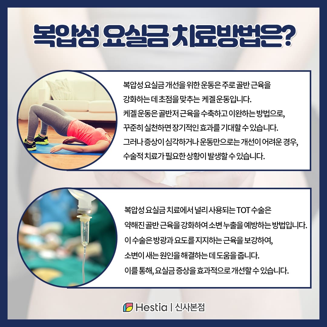 여성 배뇨장애 복압성 요실금 치료법은?
