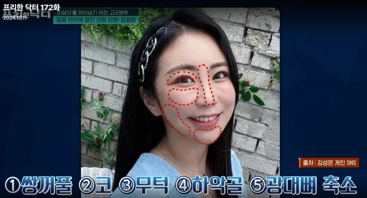 프리한-닥터-172회