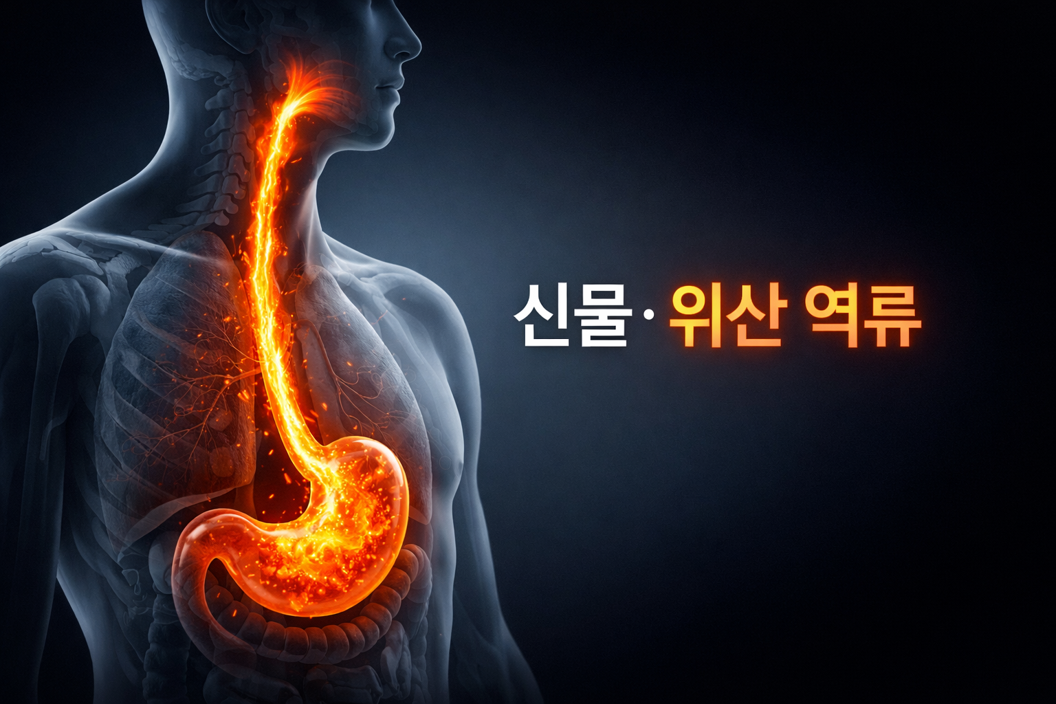 신물 위산 역류