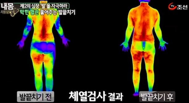 발끝치기