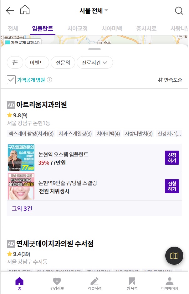 임플란트 가격 비교 사이트 검색
