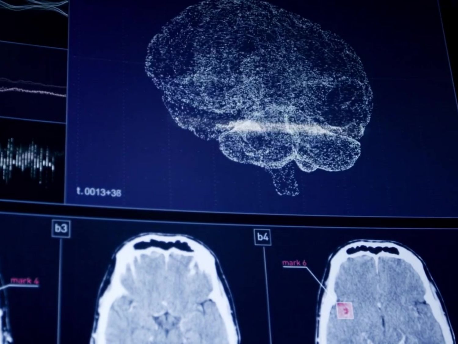 비타민B 부족증상