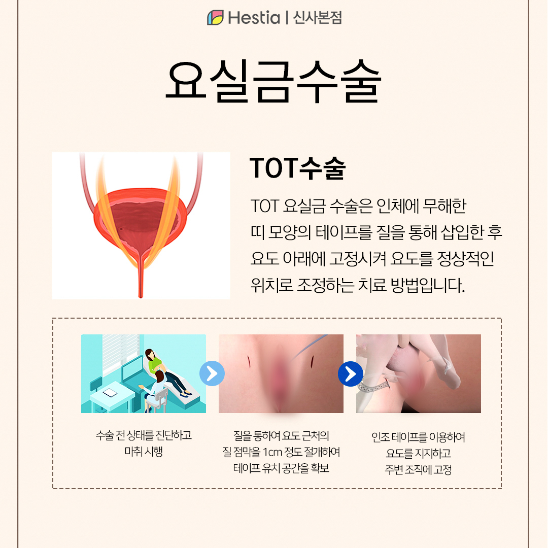 요실금이 너무 심해요! 치료가 필요한거 같다면?
