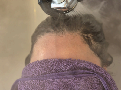 두피 냄새 줄이는 방법