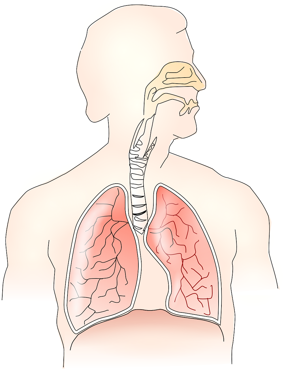 만성 기침과 가래의 숨겨진 원인, 기관지확장증이란?