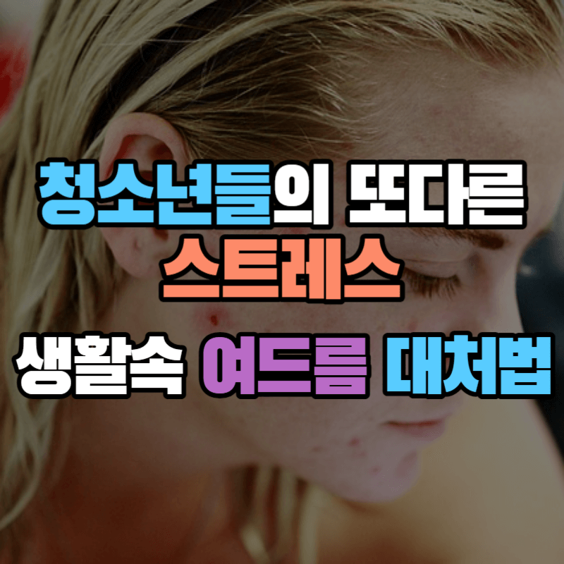 청소년들의 또다른 스트레스 : 생활속 여드름 대처법