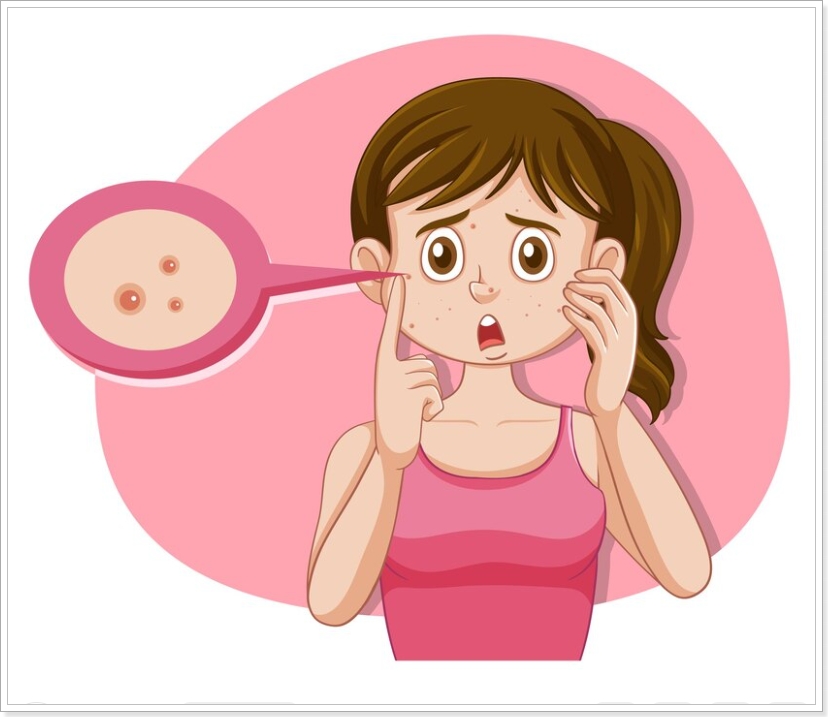 청춘의 심볼 여드름의 악화되는 이유와 증상 효과적인 치료법 및 관리법 탐구