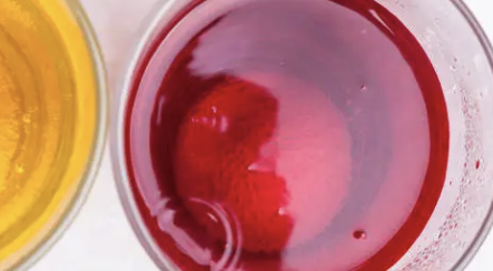 요로결석 증상 8