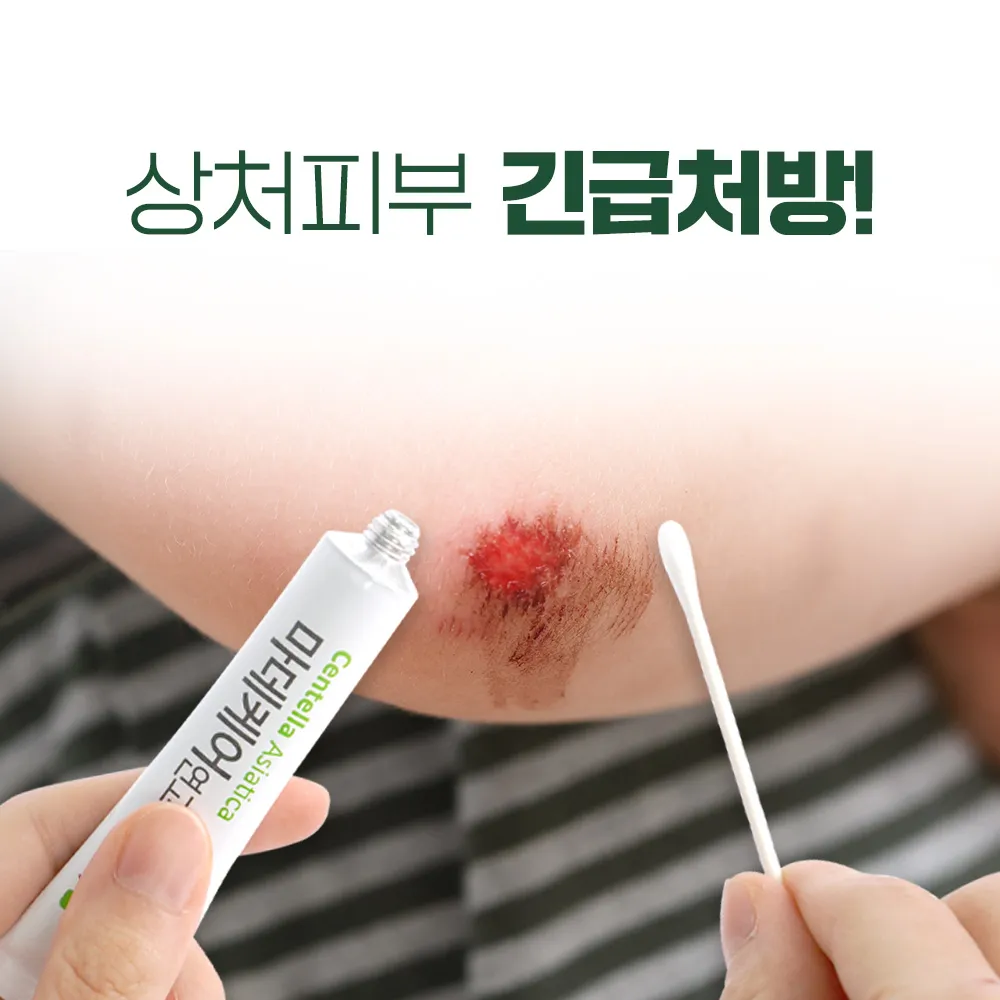 후시딘과 마데카솔 차이와 상처별 추천 사용법까지 정리한 내용_4