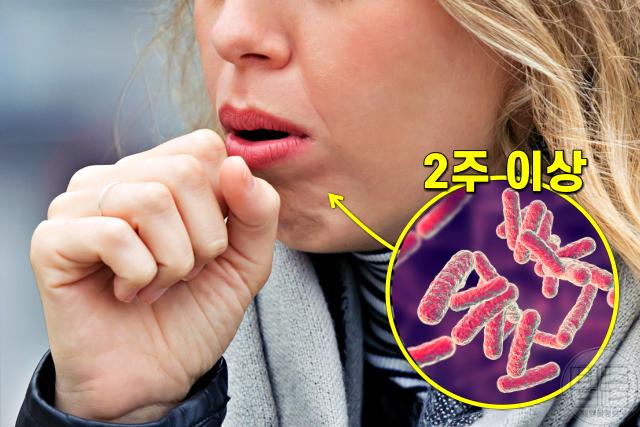 결핵 초기 증상,팁줌