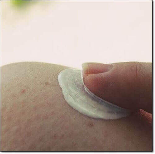 산양유 단백질 피부 건강 효과