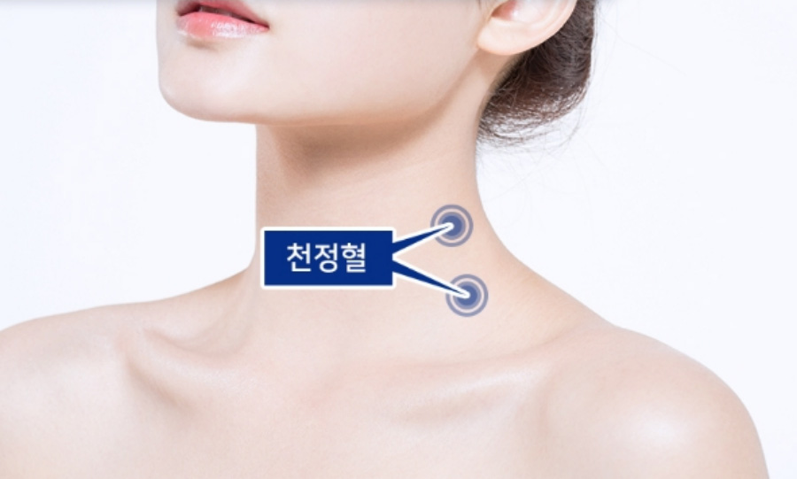 인체의 365혈 중에서 목에 위치를 하고 있는 천정혈의 정확한 위치를 표시한 이미지 사진