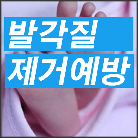아기발 사진 발 각질 제거 예방 타이틀