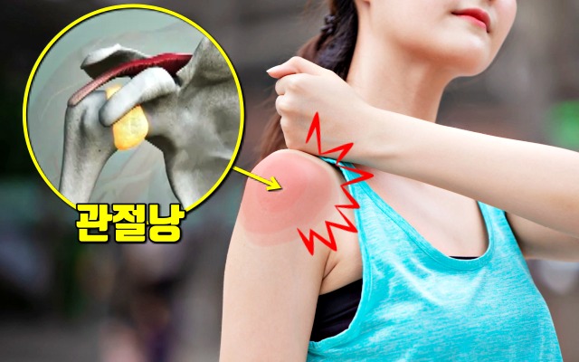어깨통증 원인, 오십견 증상, 오십견에 좋은 운동, 건강 팁줌 매일꿀정보