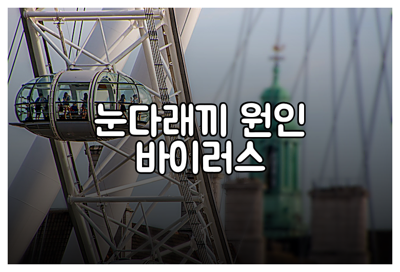 눈다래끼 원인 바이러스