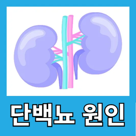 소변 거품 부종 피로감 소변량 변화 단백뇨 원인 증상 진단 치료