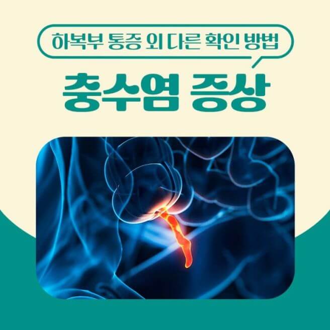 충수염 증상