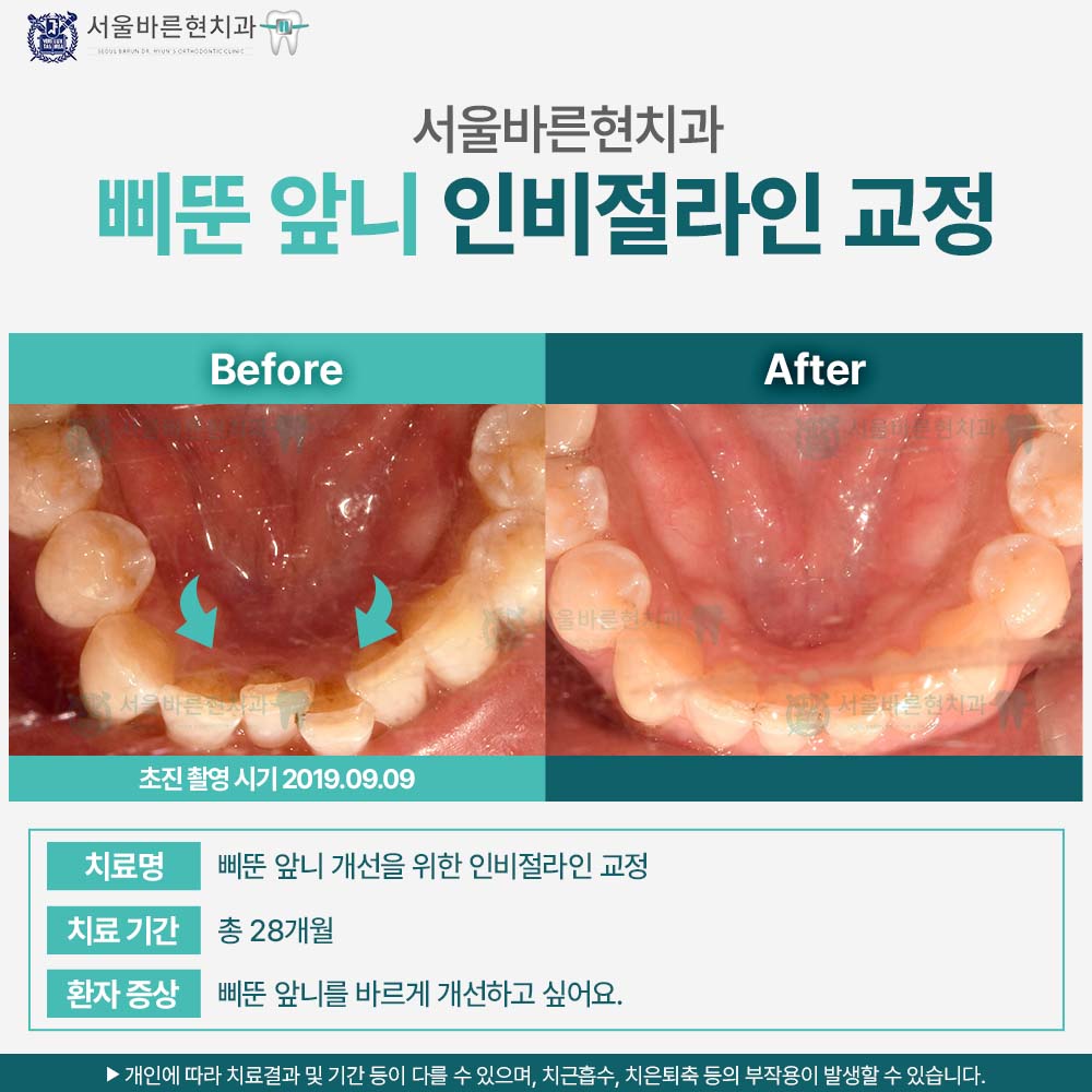 해운대인비절라인