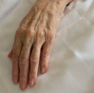 건조증 증상 피부 안구 코 구강 원인 치료법