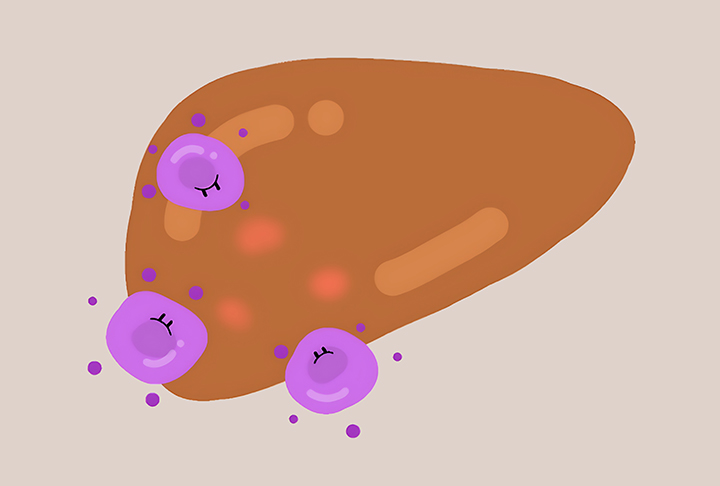 바이러스가-침입중인-간