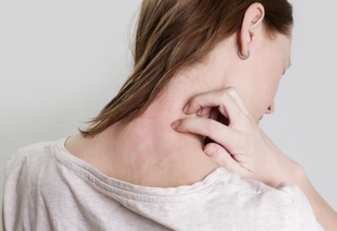 비판텐 연고 효능