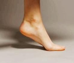 복숭아뼈 주위가 부어요, 단순한 부음일까? 물혹일까?