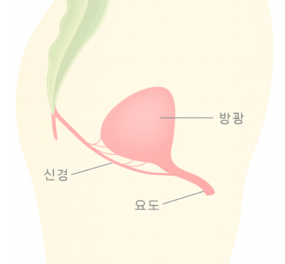 오줌이 자주 마려운 증상, 혹시 과민성 방광일까요? 치료법 총정리