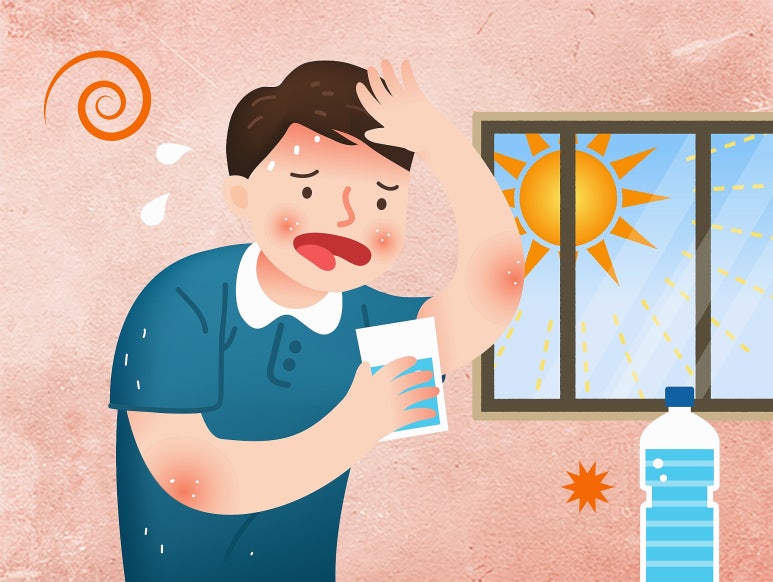 열사병 (Heat Stroke)