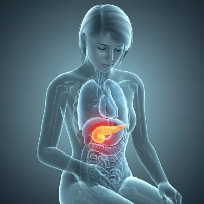 췌장염에 걸리면 췌장암으로 이어질 수도 있나요?4