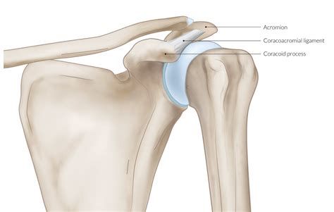 어깨충돌증후군수술