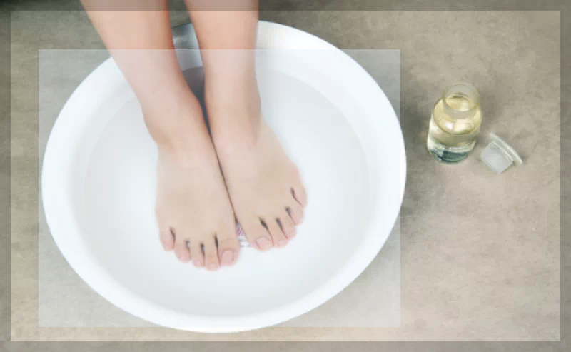 빙초산회석액 족욕