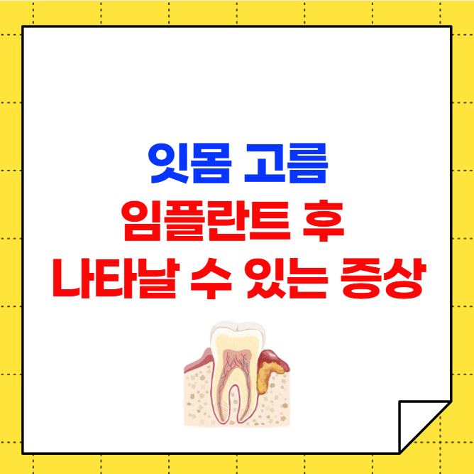 잇몸 고름 임플란트 후 나타날 수 있는 증상들
