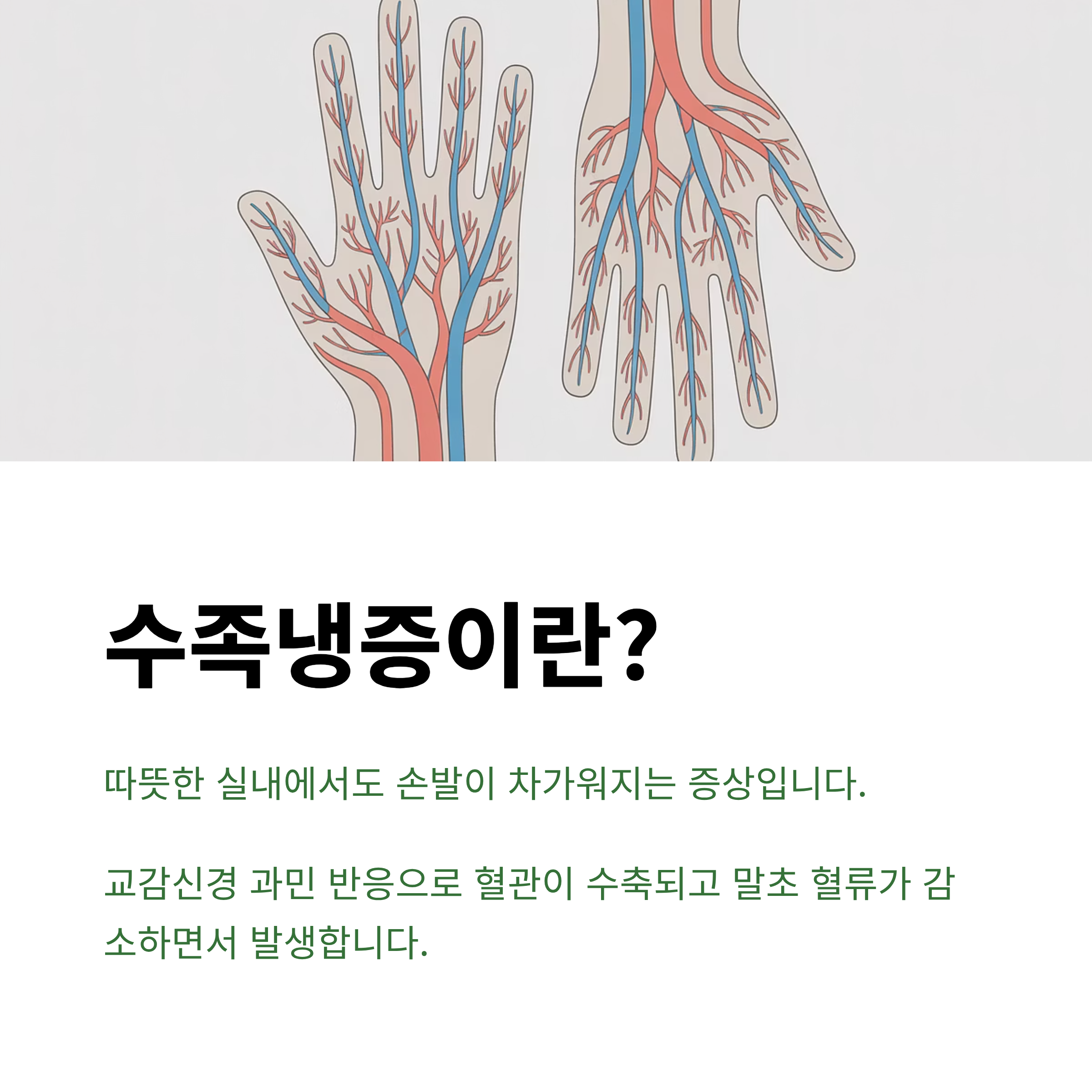 수족냉증, 수족냉증이란, 수족냉증설명, 수족냉증정의