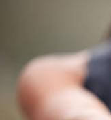 드퀘르벵 증후군&amp;#44; 손목 건초염 증상・원인・치료법