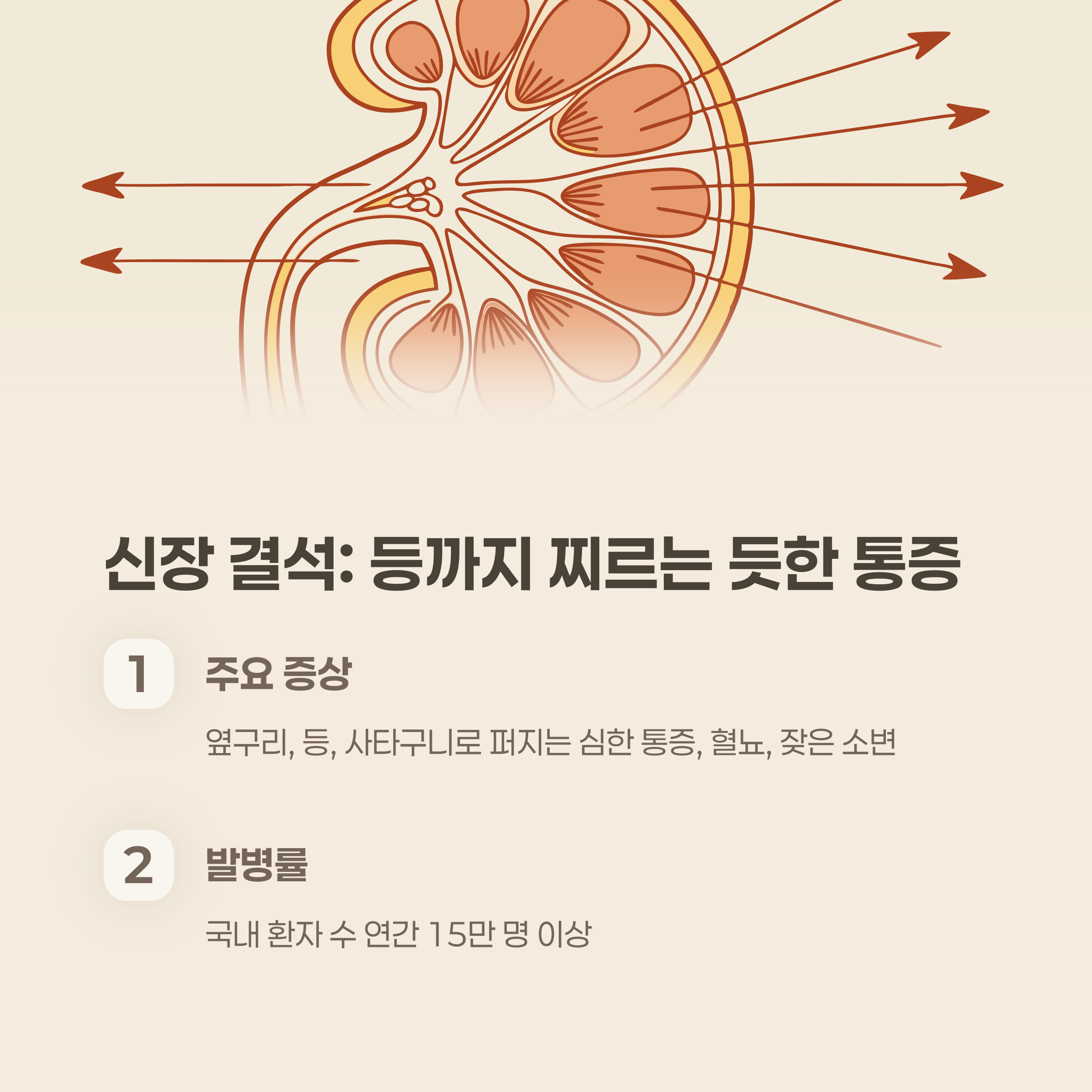 신장 결석: 등까지 찌르는 듯한 통증이 있다면