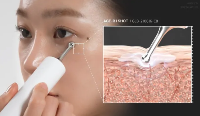 에이지알 아이샷 가격