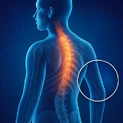 골다공증에 좋은 음식