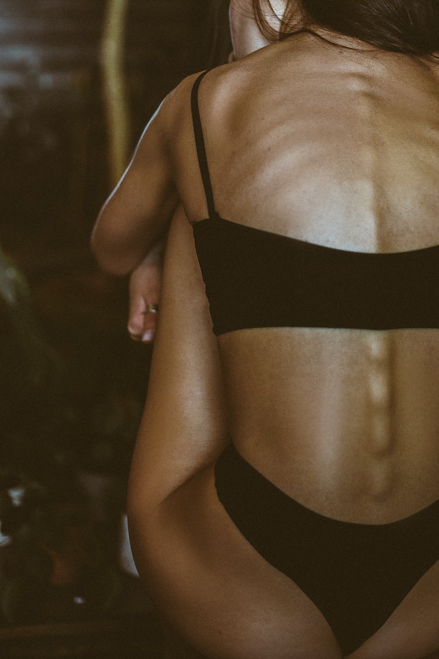 십대 청소년 척추측만증 척추뼈 돌출 사진