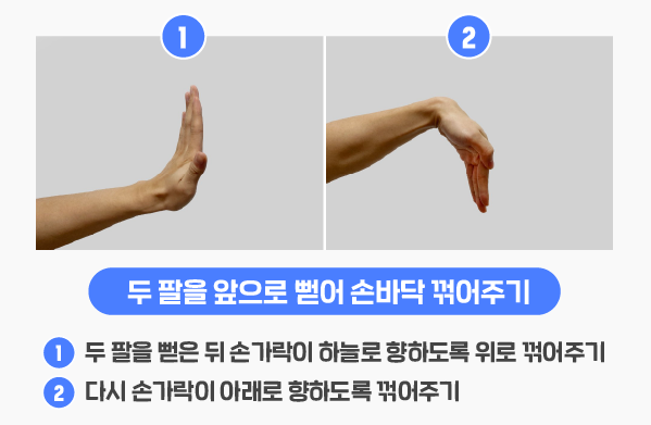 손목터널증후군 증상, 원인, 운동법