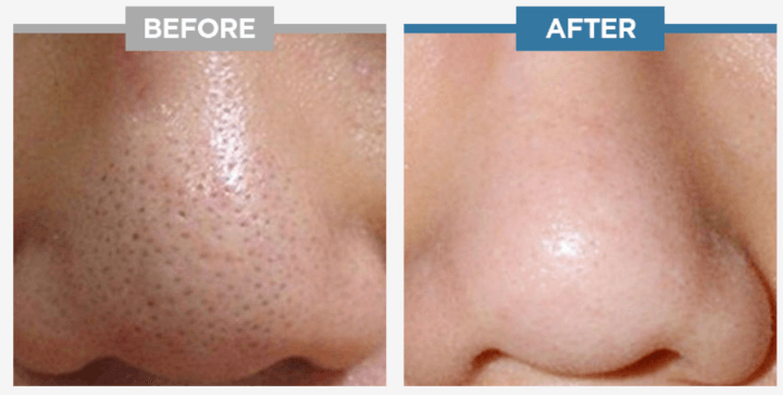 스와니코코-공식-홈페이지에서-가지고-온-제품-효과-사진