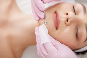 얼굴-비립종-제거