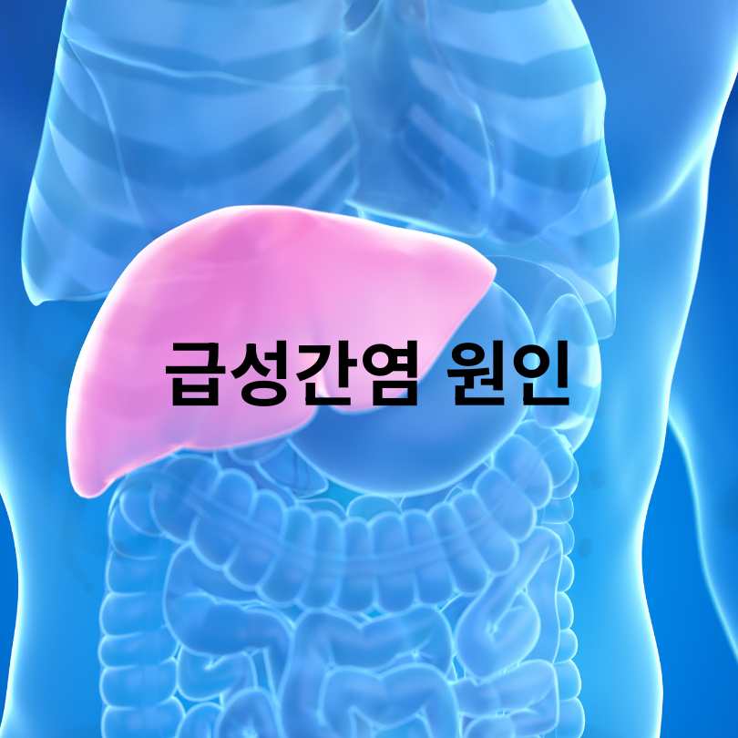 급성간염 증상·원인·치료 총정리 (군 면제 정보 포함)