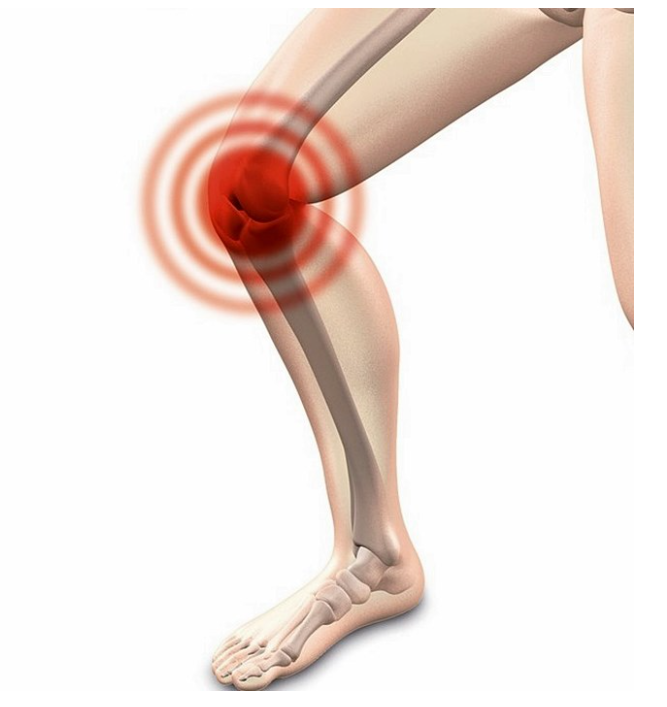 관절통치 락 효능