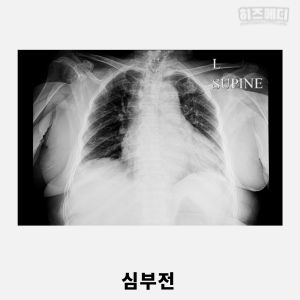 기침이 오래가는 이유