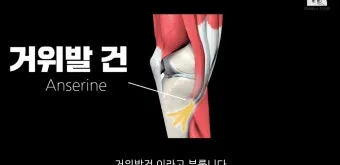 거위발 건염 원인과 증상 무릎 안쪽 통증 치료법 정리_6