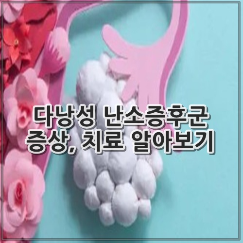 다낭성 난소증후군 증상, 치료 알아보기