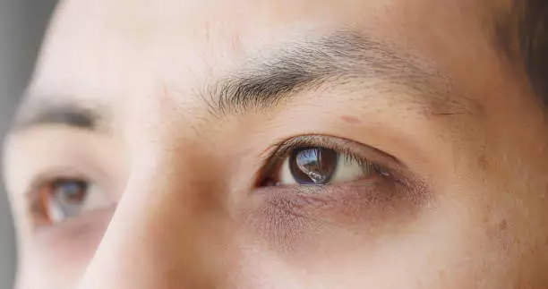 눈밑 주름 없애는 방법 9가지