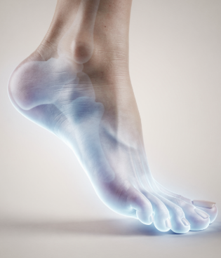 족저 근막염 증상