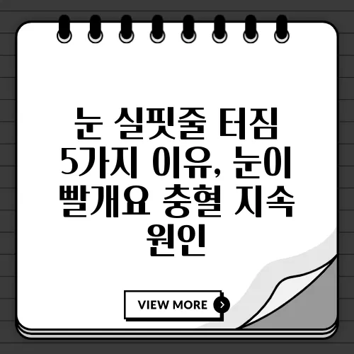 눈 실핏줄 터짐 5가지 이유, 눈이 빨개요 충혈 지속 원인