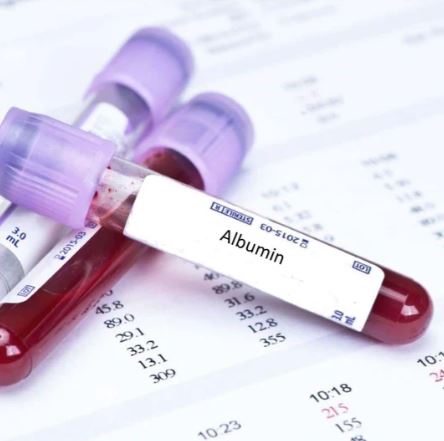 알부민-부족-증상